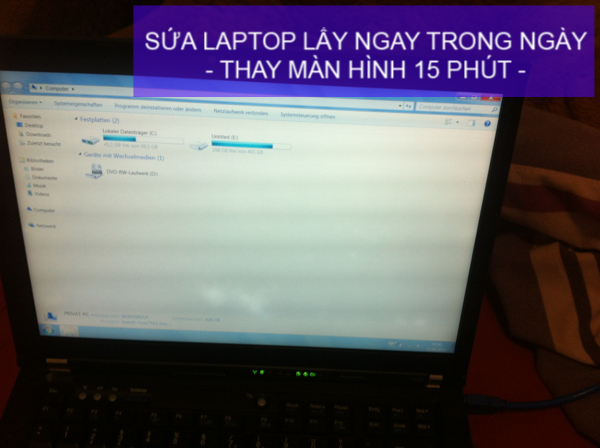 man-hinh-laptop-bi-o-vang-sua-dut-diem-lay-lien-tai-hcm-02.jpg
